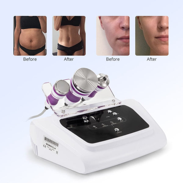 40K Unoisetion Cavitation Machine with 3 Ultrasonic Handles