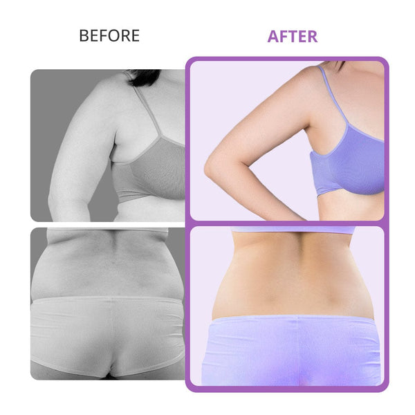 Portable 40K Home Cavitation Body Slimming Machine