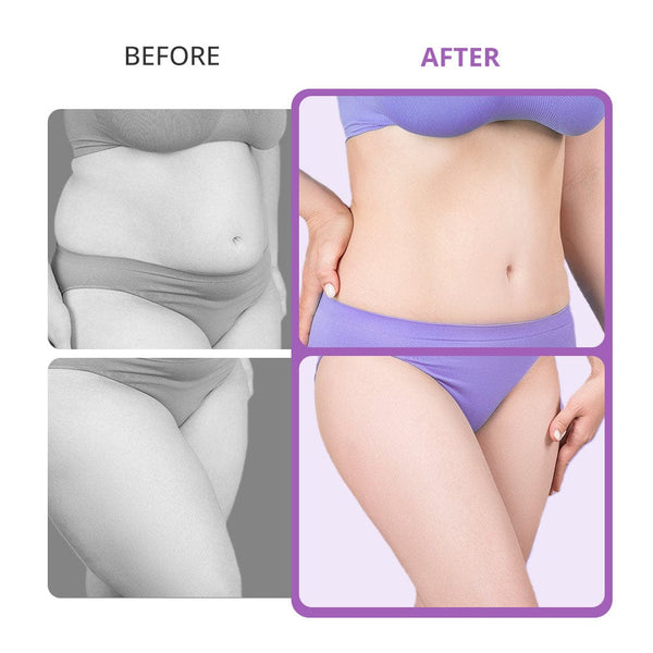 Portable 40K Home Cavitation Body Slimming Machine
