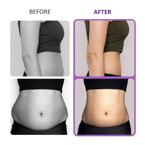 Fat Burning Machine for Home Use: Effortless Sculpting