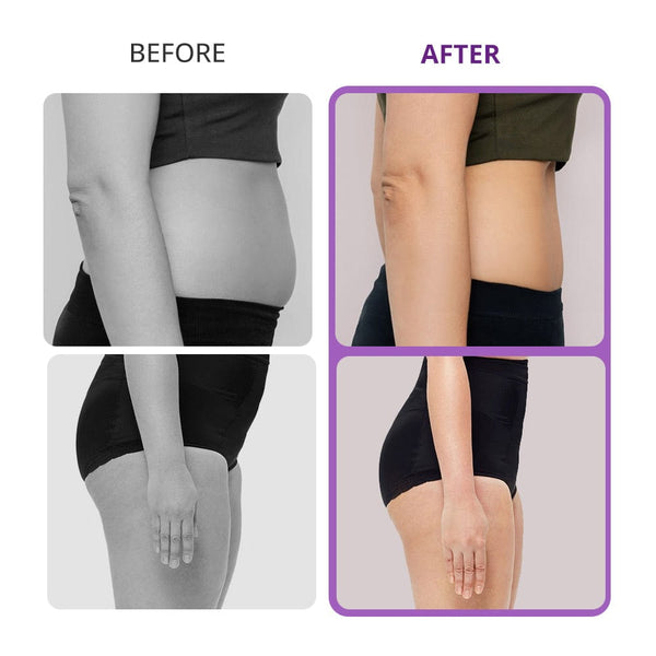 Fat Burning Machine for Home Use: Effortless Sculpting
