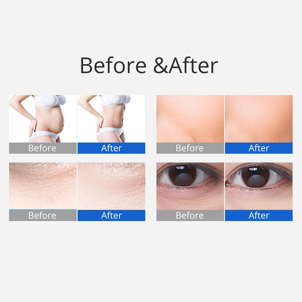 3-in-1 40K Ultrasonic Cavitation Machine for At-Home Slimming