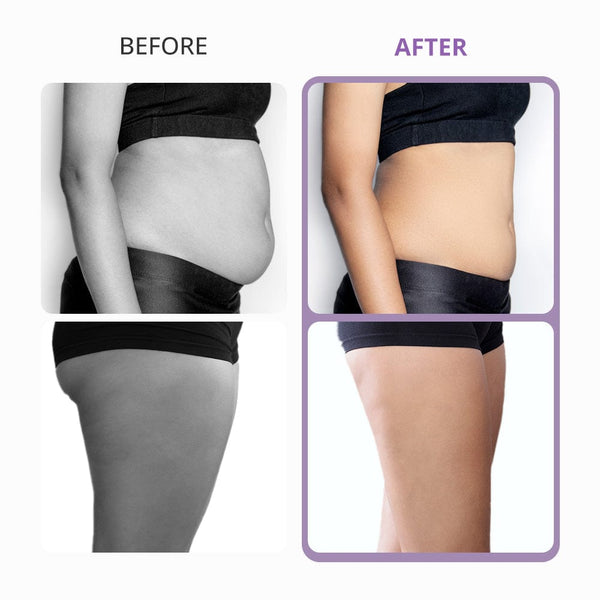 5-in-1 Ultrasonic Cavitation 40K Body Contouring Machine