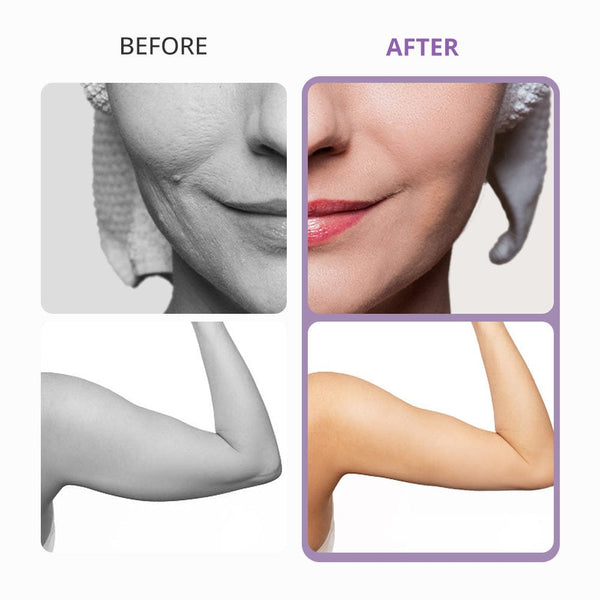 5-in-1 Ultrasonic Cavitation 40K Body Contouring Machine