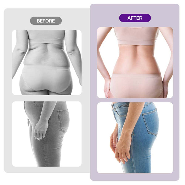 3D Smart Radio Frequency Vacuum RF Cavitation 2.0 Weight Loss Machine