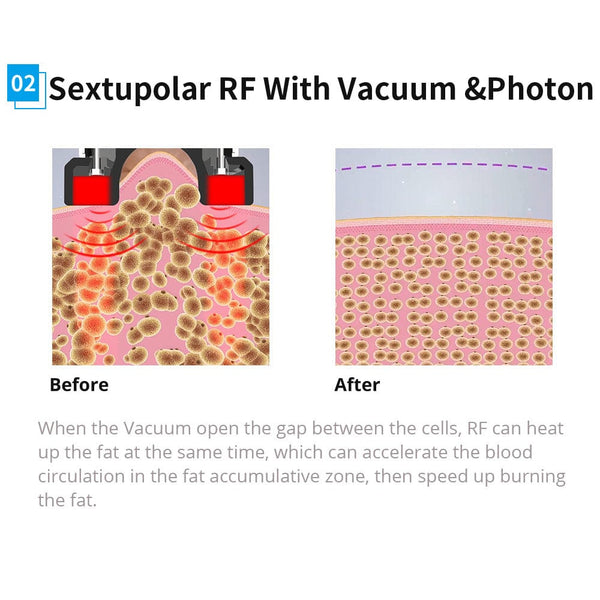 6 In 1 Cavitation RF Vacuum Slimming Machine Skin Tightening