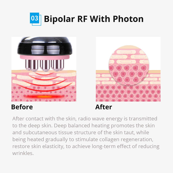 6 In 1 Cavitation RF Vacuum Slimming Machine Skin Tightening