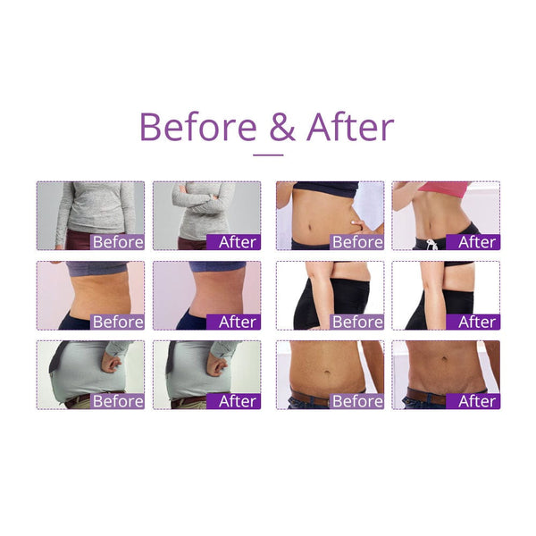 9-in-1 Ultrasonic Cavitation Machine - 40K Vacuum Slimming