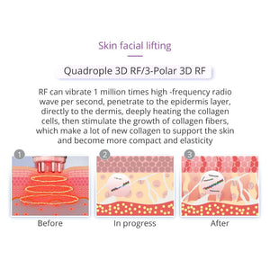 9-in-1 Ultrasonic Cavitation Machine - 40K Vacuum Slimming