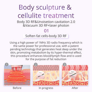 9-in-1 Ultrasonic Cavitation Machine - 40K Vacuum Slimming