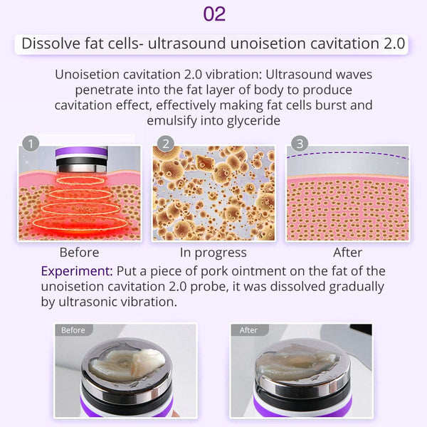 9-in-1 Ultrasonic Cavitation Machine - 40K Vacuum Slimming