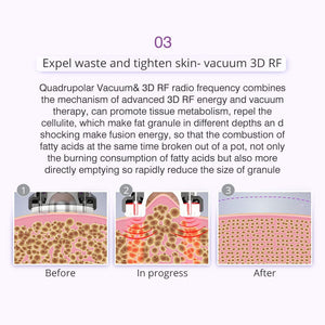 9-in-1 Ultrasonic Cavitation Machine - 40K Vacuum Slimming