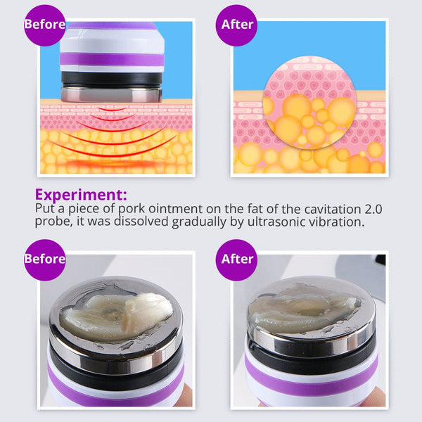 5-in-1 40K Cavitation RF Vacuum Machine - 40K cavitaion principle & before after