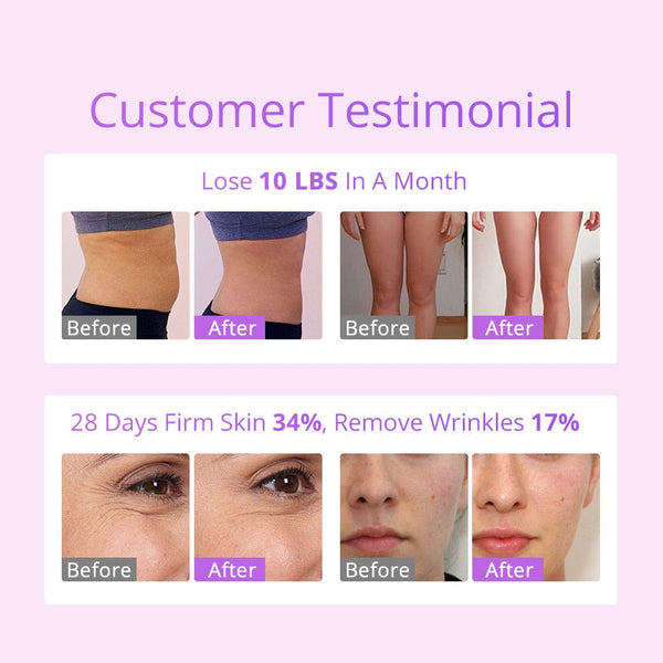 Unoisetion S Shape Lipo Cavitation Machine - 6-in-1 30K