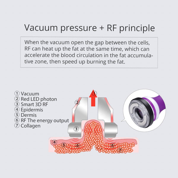 5-in-1 40K Cavitation RF Vacuum Machine - Vaccum & RF principle