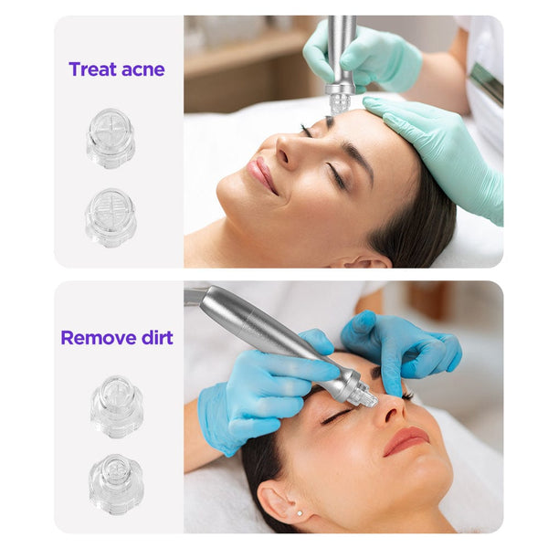 Mychway 2-in-1 Hydro Dermabrasion Machine For Deep Cleansing Hydration