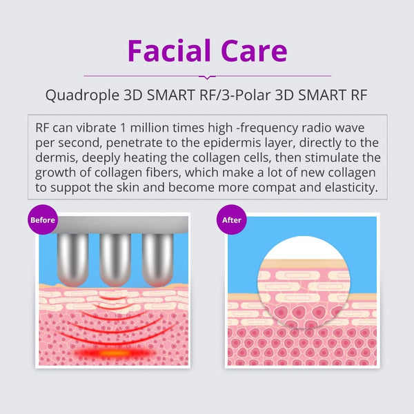 5-in-1 40K Cavitation RF Vacuum Machine - facial care