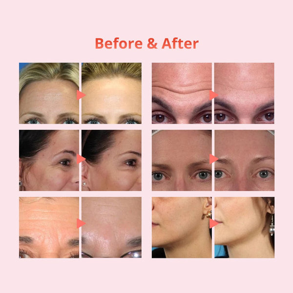 New Design Facial Ultrasound Scrubber Diamond Dermabrasion Skin Care