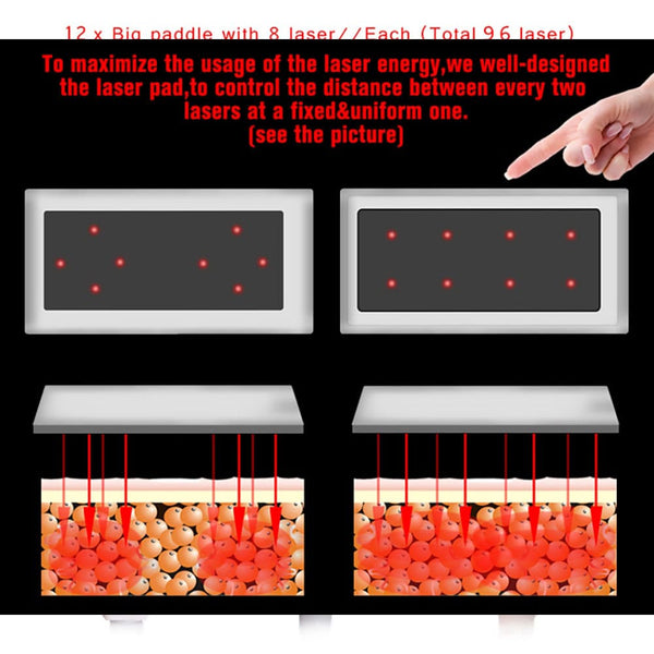 Advanced 160mw Laser Lipo Machine for Fat Burning | Mychway