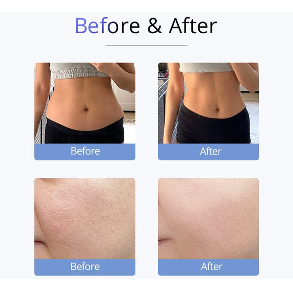 30K Cavitation S Shape Machine For Body Contouring - 4-In-1