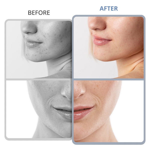 3 in 1 Diamond Microdermabrasion Machine for Facial Care