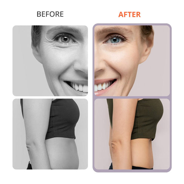 Aristorm S Shape 30K Cavitation Machine - 4-In-1 Weight Loss