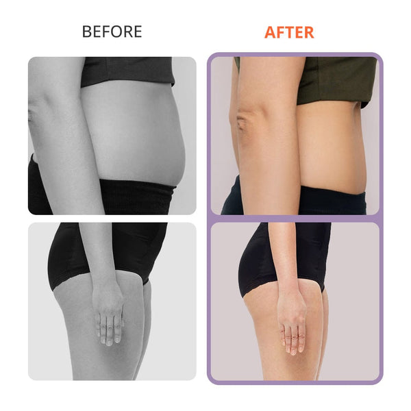 Aristorm S Shape 30K Cavitation Machine - 4-In-1 Weight Loss