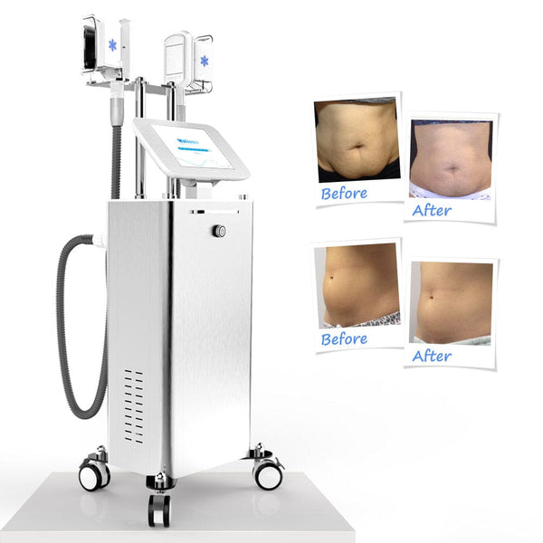 Before & After Results of MS-7201F Stand-Type Vacuum Freezing Machine