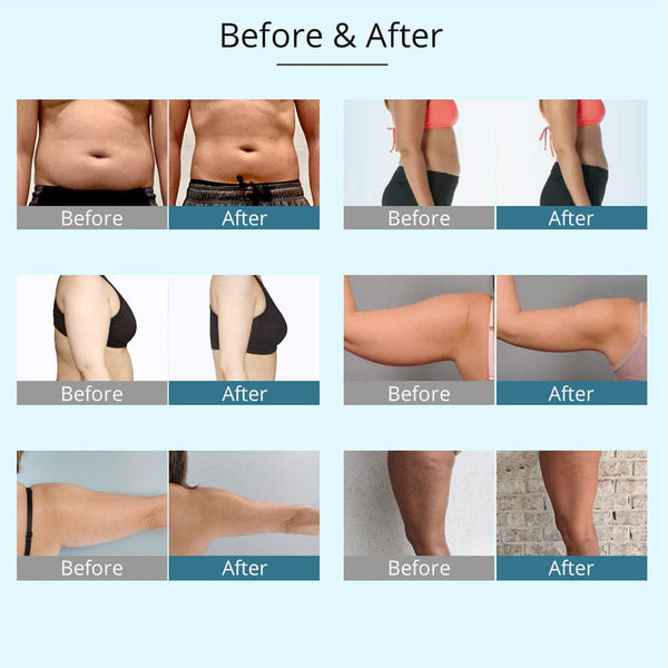 Before & After Results of MS-22S9SB 9-In-1 40K Ultrasonic Cavitation Machine