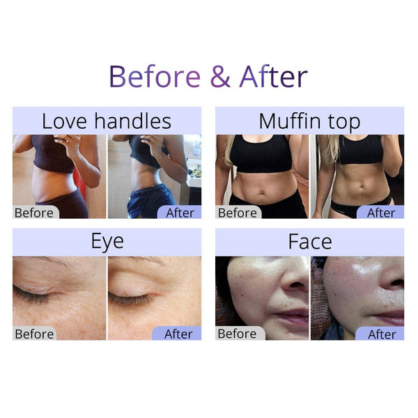 Ultrasonic 40k Cavitation RF Skin Lifting Weight Loss Fat Removal Machine