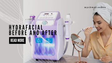 Hydra Dermabrasion Before and After: Real Photos & Simple Steps