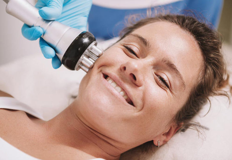What Are the Benefits Of RF Facial Skin Tightening