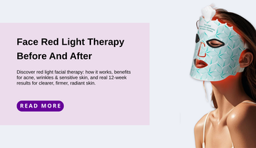 MYCHWAY Face Red Light Therapy Before And After