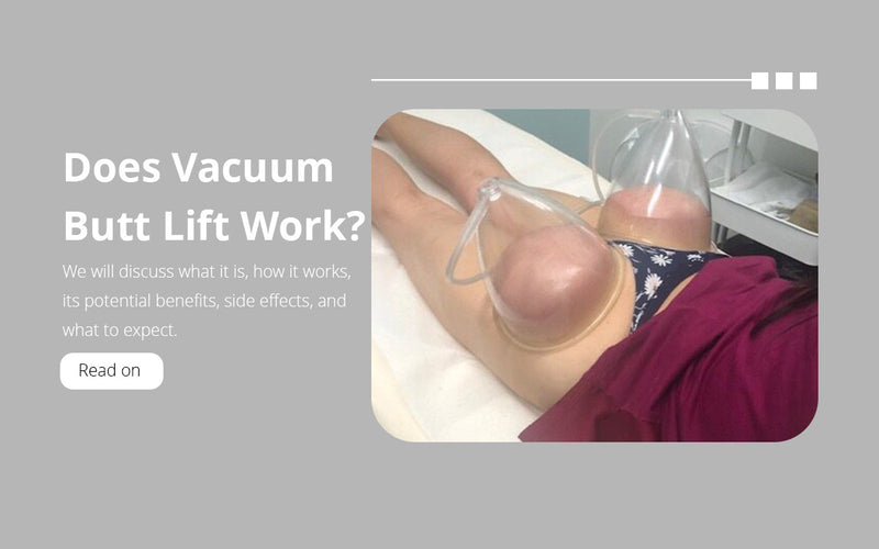 Does Vacuum Butt Lift Work?