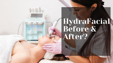 Hydrafacial Before And After