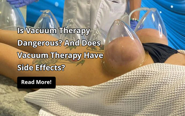 Is Vacuum Therapy Dangerous And Does Vacuum Therapy Have Side Effects