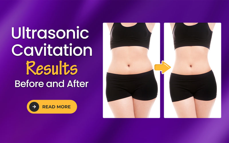 Ultrasonic Cavitation Results Before and After