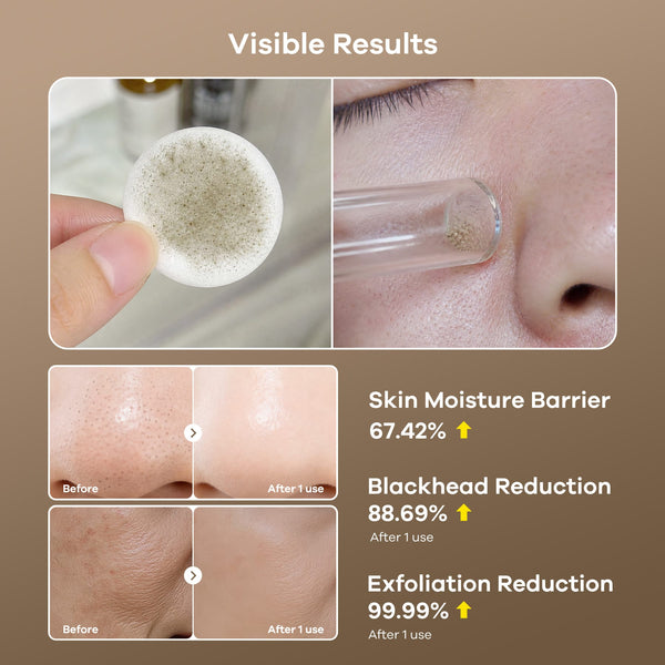 3-In-1 Diamond Microdermabrasion Machine With 9 Heads For Home Use