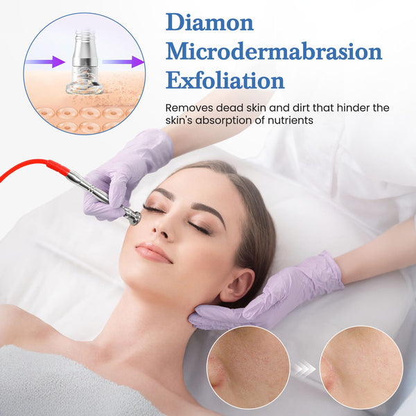 A woman lies on a treatment bed while a gloved hand applies a microdermabrasion device to her face. The image includes explanatory text reading 'Diamon Microdermabrasion Exfoliation' and two circular close-up skin comparison insets.
