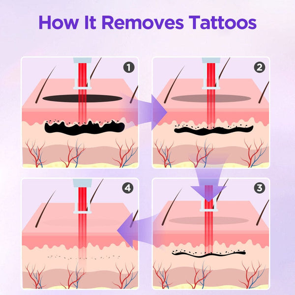 2-In-1 Picosecond 808 Diode Laser Hair Removal Machine Tattoo Removal