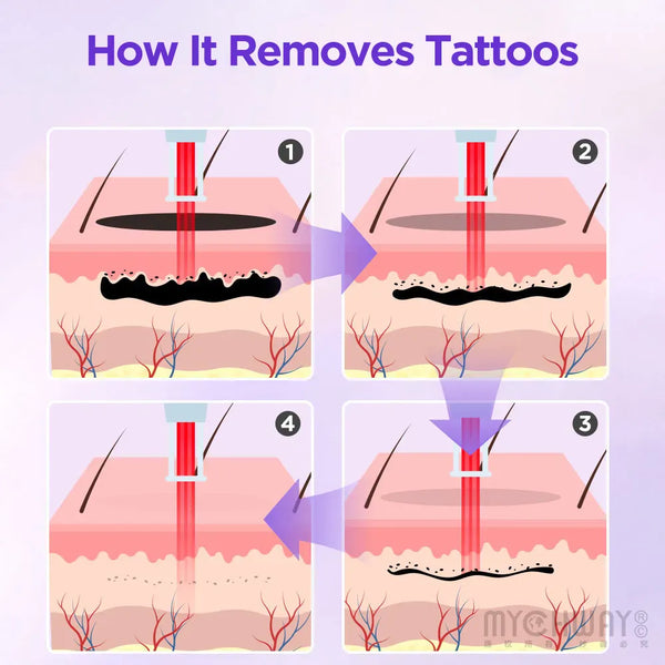 2 In 1 Pro Laser Hair Removal Machine For Hair Tattoo Removal Skin Rejuvenation