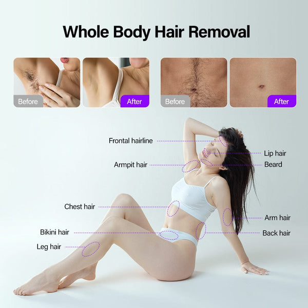 4 In 1 Professional Pico Laser Diode Hair Removal Skin Rejuvenation Machine