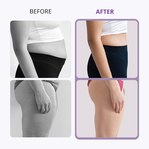 Mychway 8-In-1 40K Cavitation Machine For Body Shaping & Facial Rejuvenation