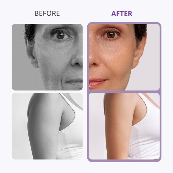 Mychway 8-In-1 40K Cavitation Machine For Body Shaping & Facial Rejuvenation