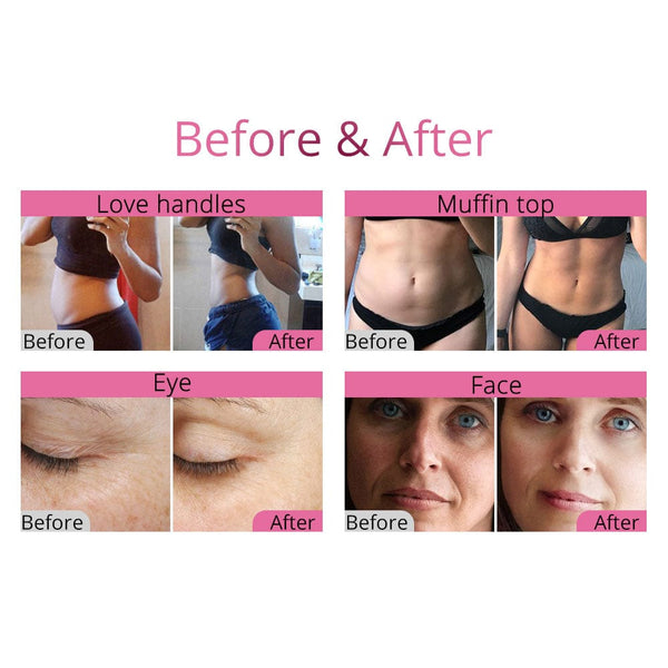 Cavitation RF Vacuum Machine - Body Shaping & Skin Lifting
