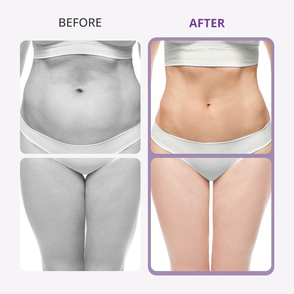 Aristorm 40K Cavitation Machine With Microcurrent For Body & Facial Spa