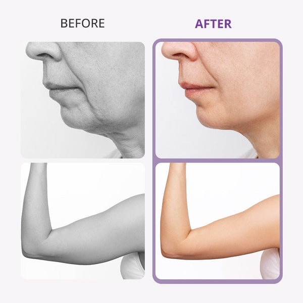 Aristorm 40K Cavitation Machine With Microcurrent For Body & Facial Spa