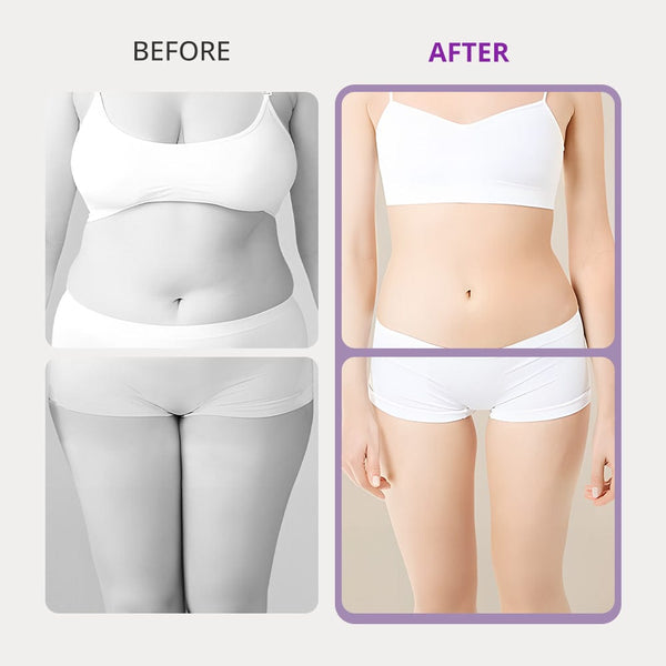 Lipo Cavitation Vacuum RF Machine - 10-in-1 40K