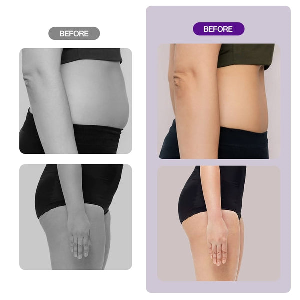 9-in-1 40k Lipo Cavitation Machine For Body Sculpting & Facial Care