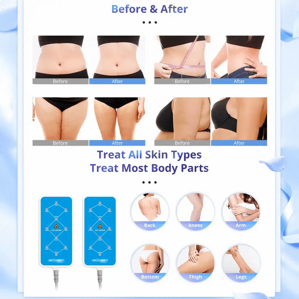 160mw Lipo Laser Machine With 2 LED Pads For Body Sculpting